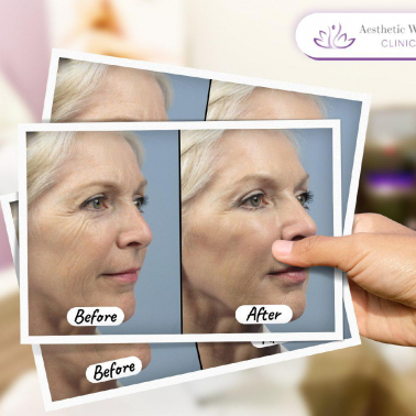 Aesthetic World Clinic Social Media Post