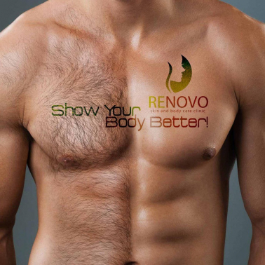 Renovo Skin & Body Care Clinic Social Media Post