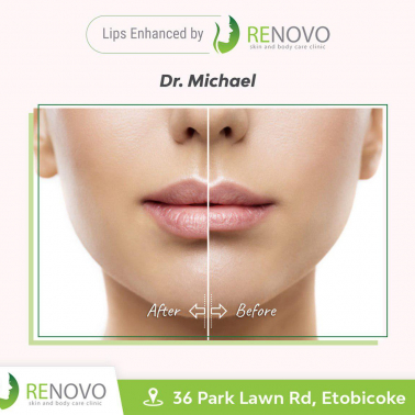 Renovo Skin & Body Care Clinic Social Media Post