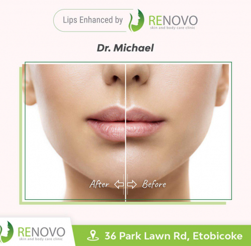 Renovo Skin & Body Care Clinic Social Media Post